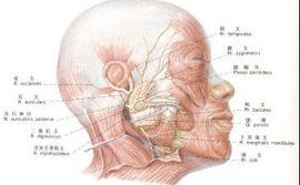 貝爾麻痹 貝爾麻痹