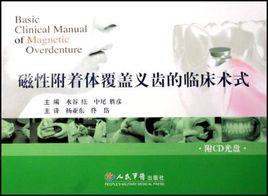 磁性附著體覆蓋義齒的臨床術式 磁性附著體覆蓋義齒的臨床術式