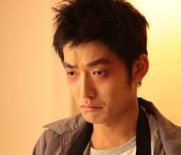 熊貓眼[生理現象]