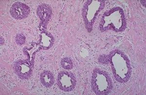 皮纖維細胞 皮纖維細胞