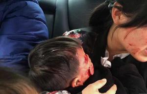 4·16蕪湖男孩被狗咬傷事件 4·16蕪湖男孩被狗咬傷事件