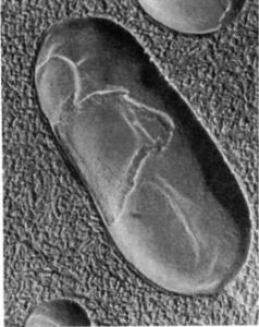 無定形孢囊菌屬