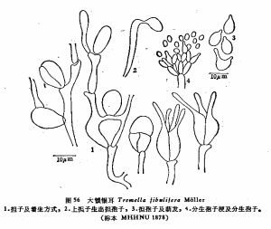 大鎖銀耳 大鎖銀耳