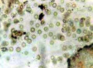 六前鞭毛蟲屬 六前鞭毛蟲屬