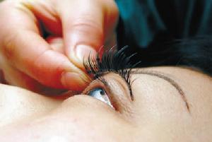 淺層點狀角膜炎