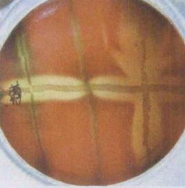 CAMP試驗 CAMP試驗