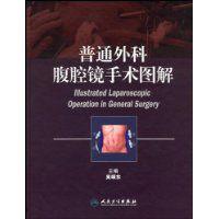 普通外科腹腔鏡手術圖解 普通外科腹腔鏡手術圖解