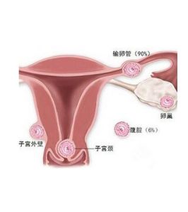 出血時間 出血時間