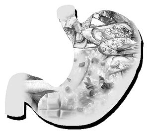 急性出血性腸炎