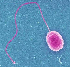 副溶血弧菌食物中毒 副溶血弧菌食物中毒