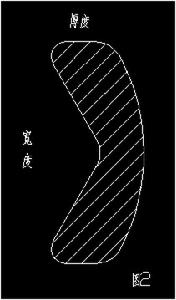 圖2 圓背V形圈絲