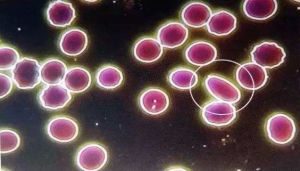 紅細胞顆粒 紅細胞顆粒