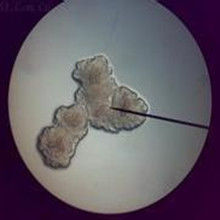 伴放線放線桿菌