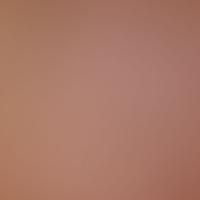 HR 6000 IRAS 彩色圖