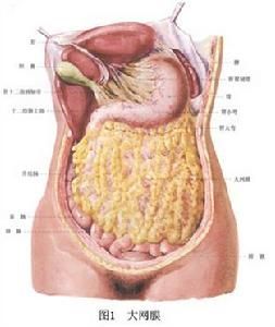 大網膜扭轉 大網膜扭轉