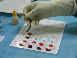 血型試紙 血型試紙