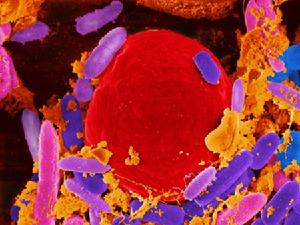 隱孢子蟲 隱孢子蟲