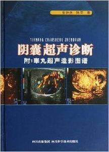 陰囊超聲診斷 陰囊超聲診斷