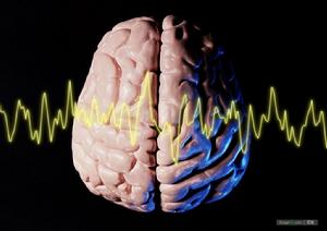 大腦皮層聯合區 大腦皮層聯合區