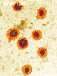 慢性化膿性腮腺炎