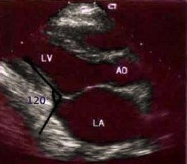 心包叩擊音 心包叩擊音