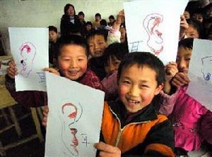 （圖）傳導性耳聾