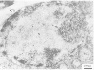 感染水稻黃矮病毒的水稻葉片薄壁細胞
