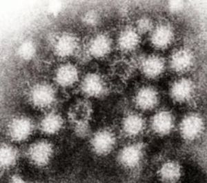 摧毀諾如病毒 摧毀諾如病毒