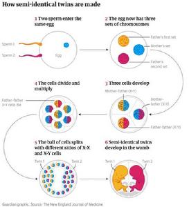 半同卵雙胞胎 半同卵雙胞胎