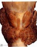 甲狀旁腺功能減退症