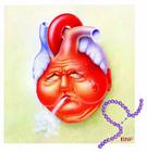 心功能障礙 心功能障礙