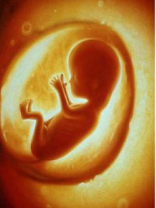 胎盤老化 胎盤老化