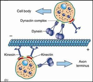 運動神經元疾病