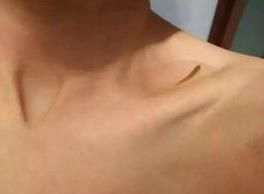 鎖骨養魚 鎖骨養魚