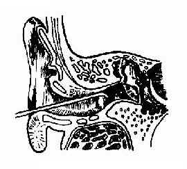 外耳道異物鉤出法