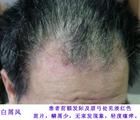 白屑風 白屑風