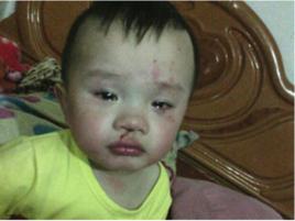 9·22汕頭父親虐兒事件 9·22汕頭父親虐兒事件