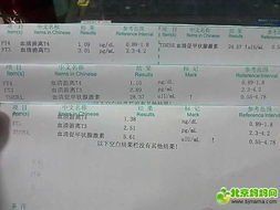 血清促甲狀腺激素 血清促甲狀腺激素