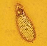 膜狀急纖蟲 膜狀急纖蟲