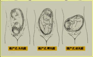 胎產式