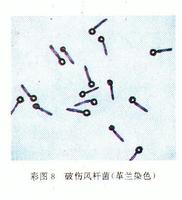 梭狀芽胞桿菌
