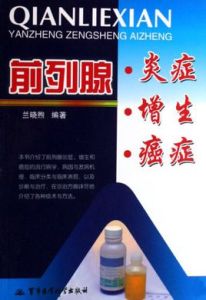 前列腺炎症增生癌症 前列腺炎症增生癌症