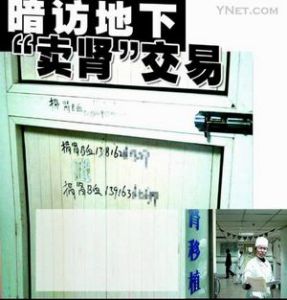 組織販賣人體器官罪 組織販賣人體器官罪