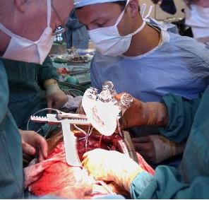 （圖）人造心臟工作原理