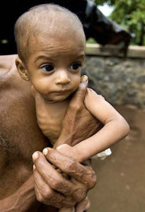 營養不良 營養不良