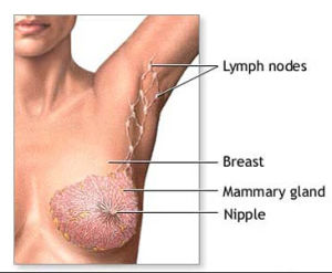 乳腺癌化療