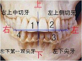 牙位3