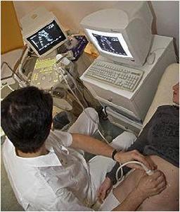 NT[NT（胎兒頸部半透明組織厚度）]