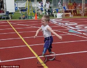 安裝假肢的科迪已可以同肢體健全的兒童賽跑