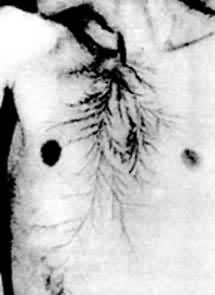 電流損傷 電流損傷